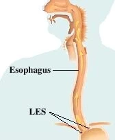 Illustration of the esophagus and LES