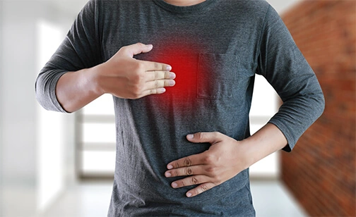 MAN with symptomatic acid reflux