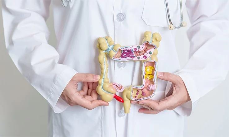 Doctor holding human Colon anatomy model