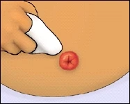Cleaning Around the Stomach