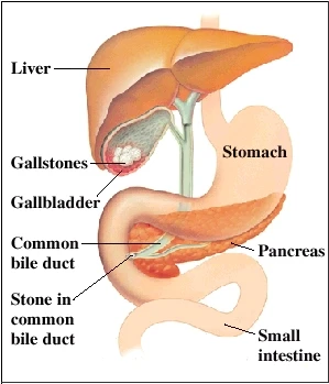 Understanding Pancreatitis