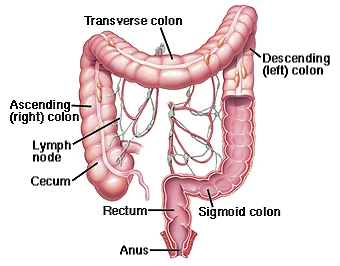 Colon And Rectal Cancer (Colorectal Cancer)