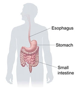 Stomach (Gastric) Cancer