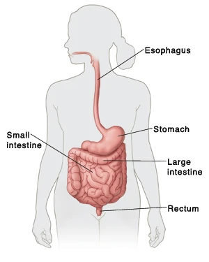 Ileus