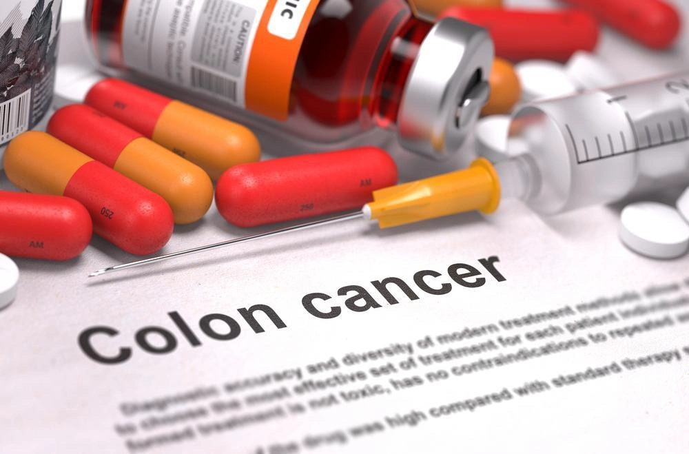 Colon cancer definition