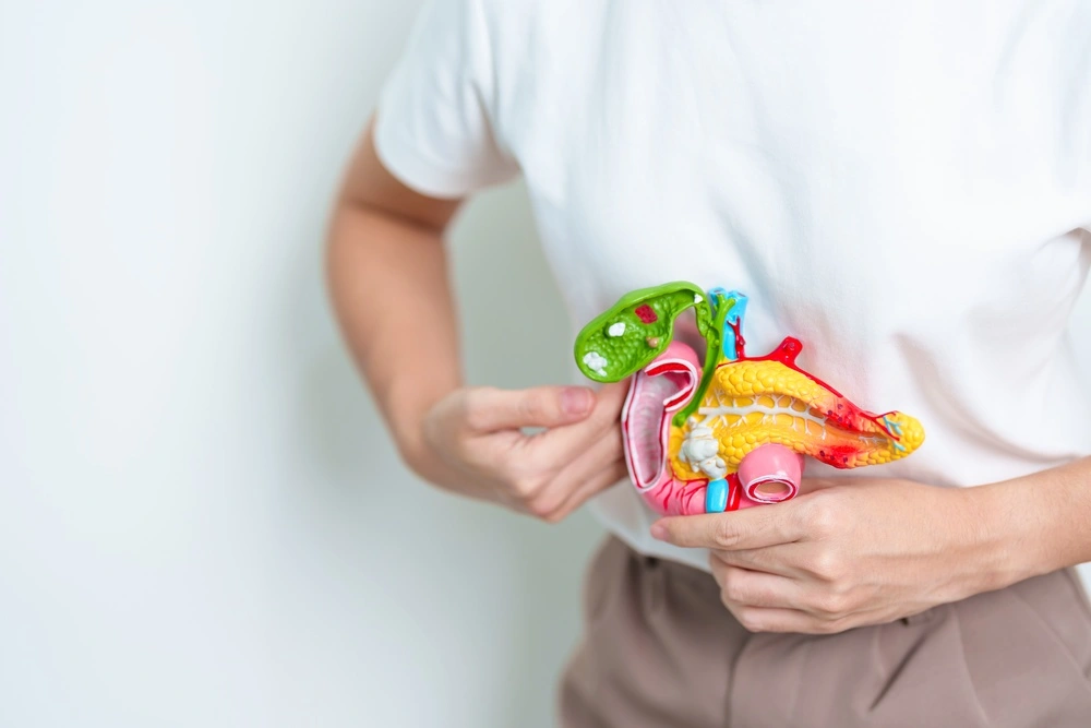 Woman holding human Pancreatitis anatomy model with Pancreas, Gallbladder, Bile Duct, Duodenum, Small intestine.