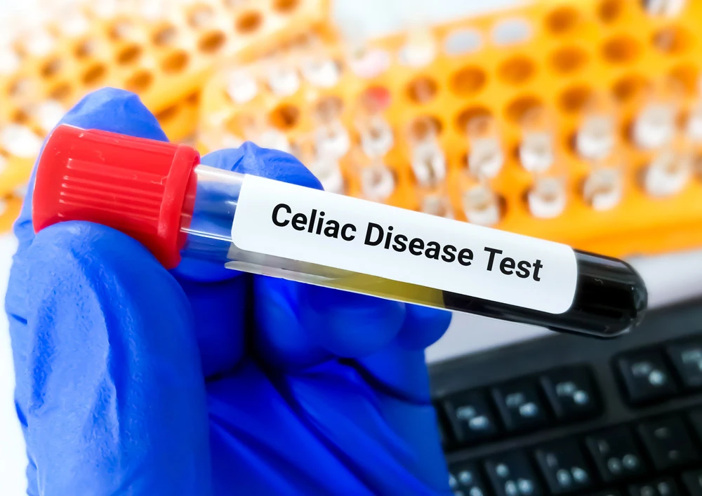 Celiac Disease Test