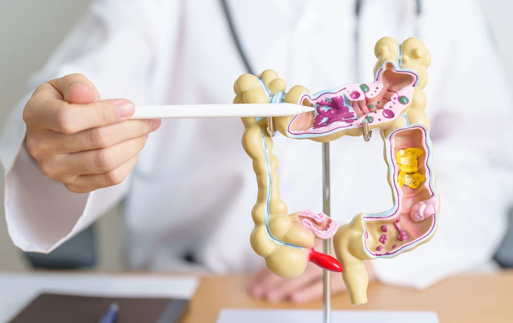 Doctor with human Colon anatomy model.
