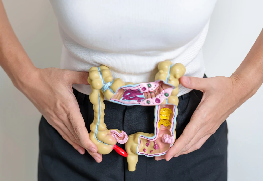 Woman holding human Colon anatomy model.