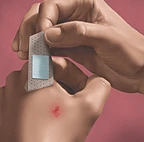 Care for Open Wounds